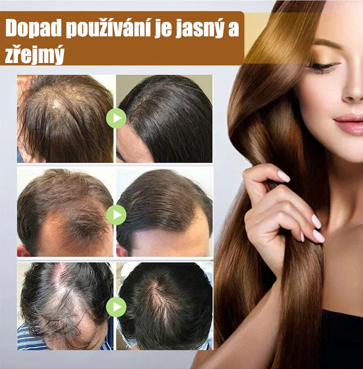 Biotinový sprej pro růst vlasů0925