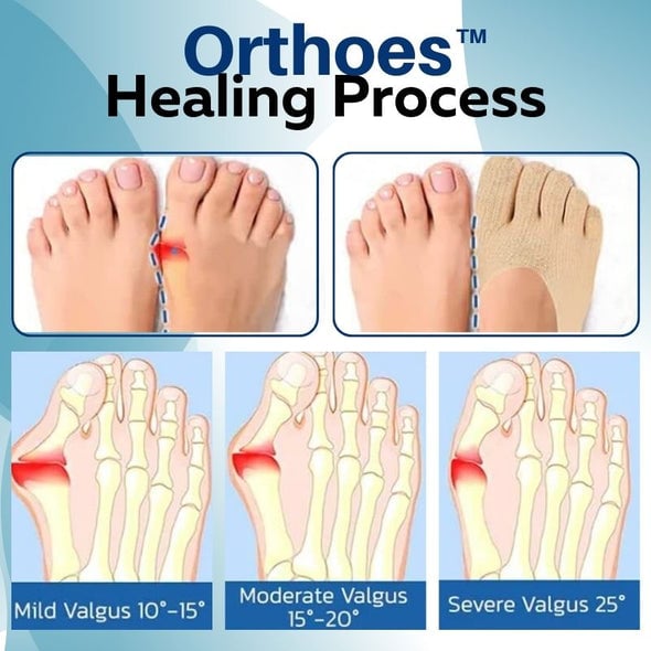 Ortopedické ponožky Orthoes™