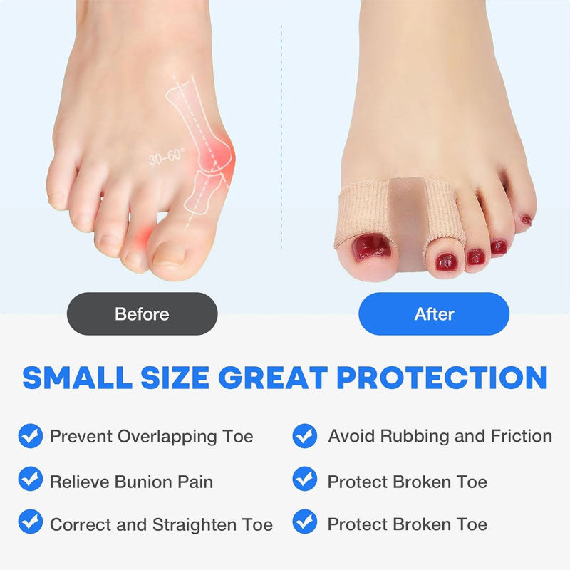 Oddělovač prstů a korekce hallux valgus🦶