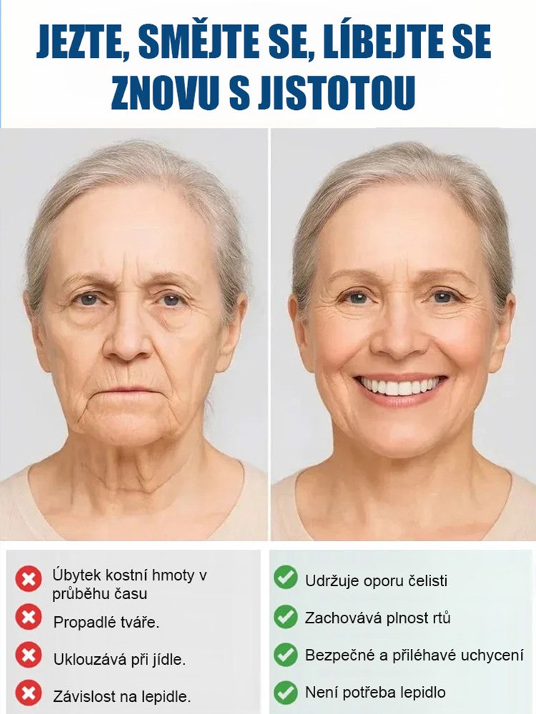 Celosvětově přes 300 000 uživatelů: souprava celkové kosterní podpory zubní protézy.