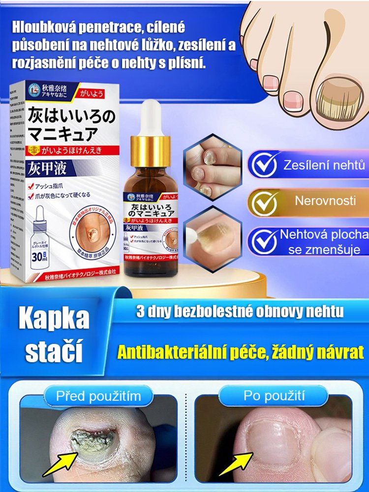 【3denní bezbolestná výměna nehtu】Zahušťující a rozjasňující péče o nehty s plísní Získejte krásné a zdravé nehty už za 3 dny – bez bolesti!