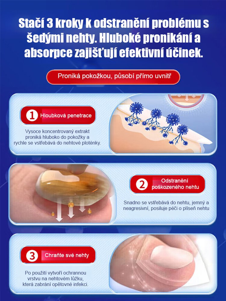 【3denní bezbolestná výměna nehtu】Zahušťující a rozjasňující péče o nehty s plísní Získejte krásné a zdravé nehty už za 3 dny – bez bolesti!