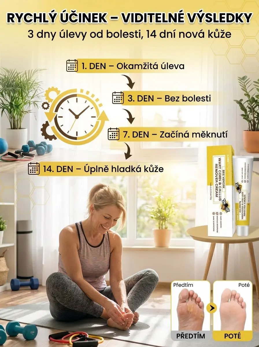 Krém na odstranění kuřích ok a mozolů s včelím jedem