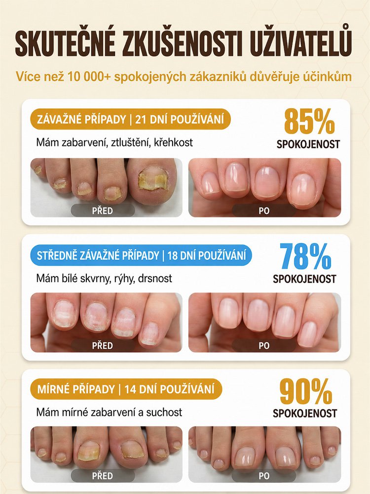 【7 dní pro jasné nehty】Kapky s včelím jedem pro péči o nehty