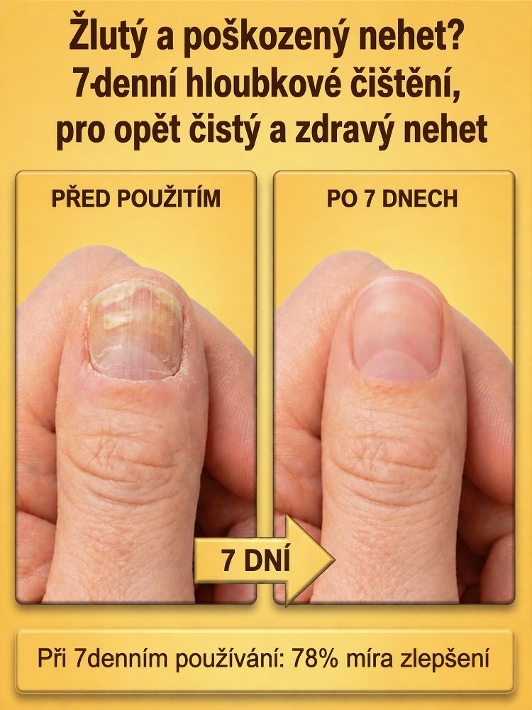 【7 dní pro jasné nehty】Kapky s včelím jedem pro péči o nehty