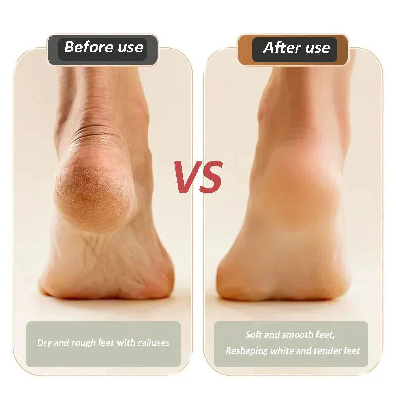 💥Nový USB dobíjecí elektrický leštič nohou